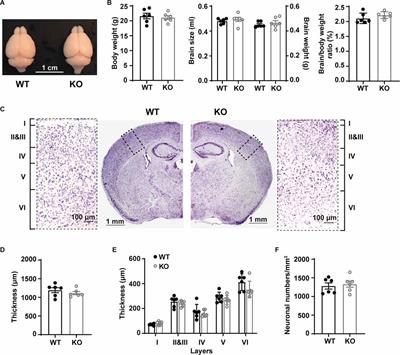 Genetic Deficiency of p53 Leads to Structural, Functional, and Synaptic Deficits in Primary Somatosensory Cortical Neurons of Adult Mice